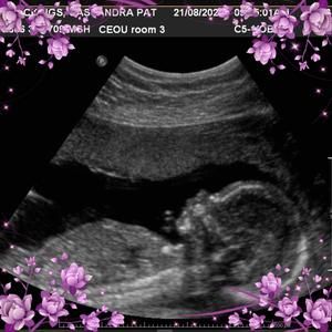 Meet your Posher, Cassandra